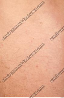 photo texture of white skin 0016